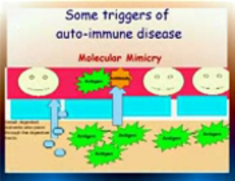 Natural Treatment For Graves Disease (hyperthyroidism)