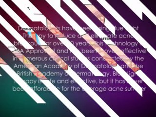 Bluemd-Blue Light Acne Treatment