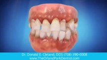 periodontics Orland Park il | gum care | general dentist