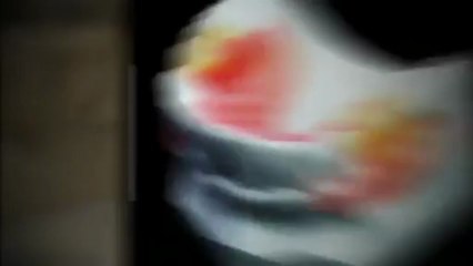 Outsourcing with CN Dental Laboratory Inc.- CNdentallab.com