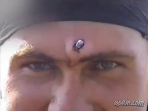 Soldat russe a une balle dans le front