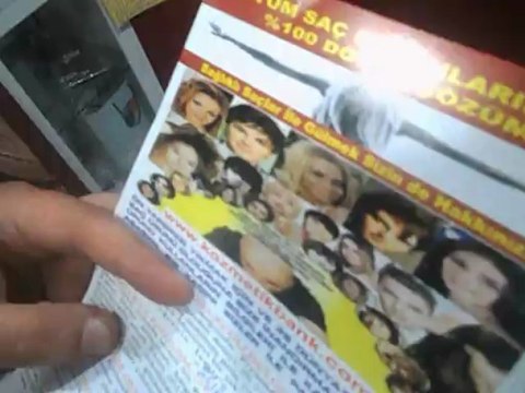 KULLANANLARI DİNLEYİN SAÇ SORUNU OLUP NASIL YENİ SAÇ ÇIKTI PART 1