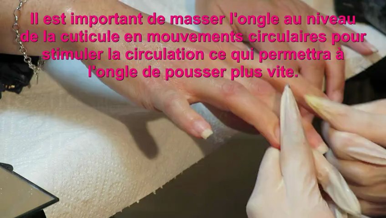 dépose