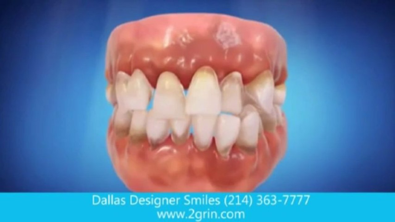 Dallas Designer Smiles reviews dallas