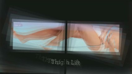 Rinoplastia étnica, São Paulo - SP - Brasil | 55 11 3885-4511 -Call Now! - Dr. Marcelo Wulkan