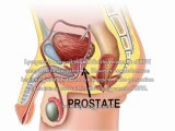 Naturopathic Treatment For Prostate Enlargement - What's The Best Naturopathic Treatment For Prostate?