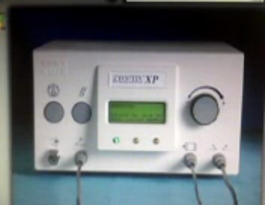 zyoptix xp