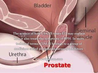 Cialis And Prostate Problems - Is Cialis Good For Benign Prostatic Hypertrophy?