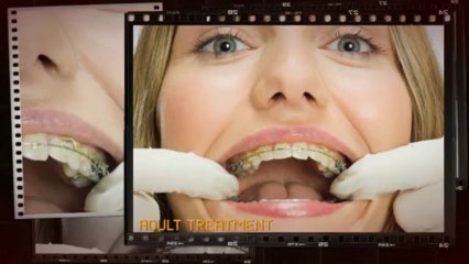 Straighten Your Teeth With Our Orthodontics Cary