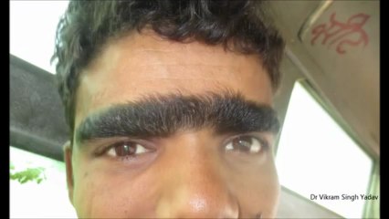 Le plus gros mono-sourcil du monde