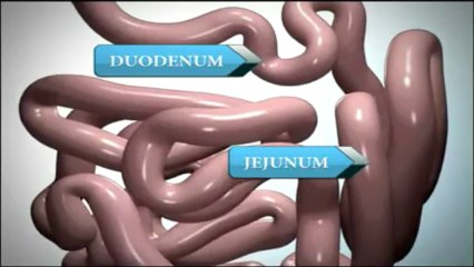 weight loss surgery beverly hills