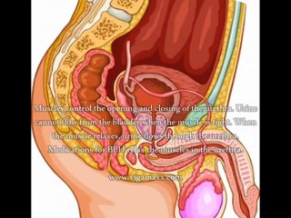 Prostate Swelling Medication - What's The Best Medication For Swollen Prostate?