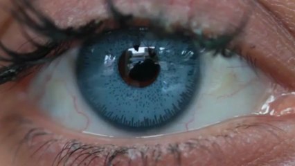 Surgery now turns brown eyes blue / brightocular