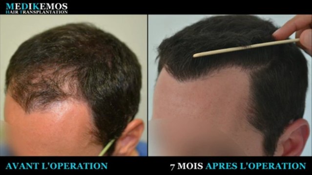 FUE 3190 UFs Dr Lupanzula (MeDiKemos)-FR