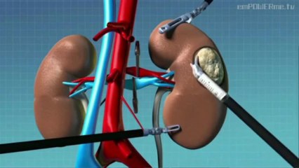 Gallbladder Disease with Dr. Jason Cohen