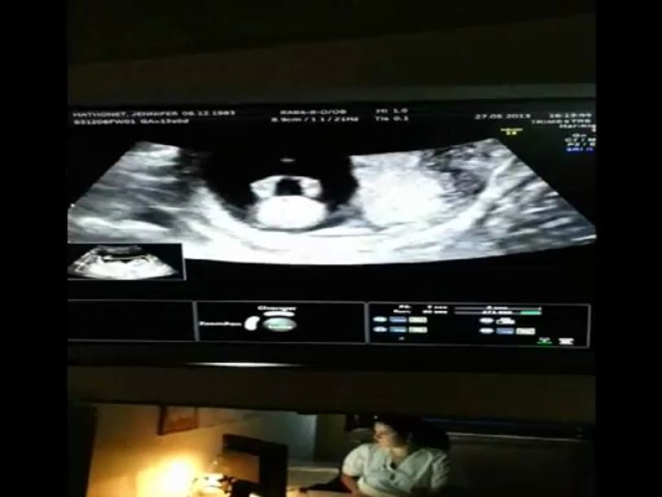 Echographie 1er trimestre: Jennifer et Damien