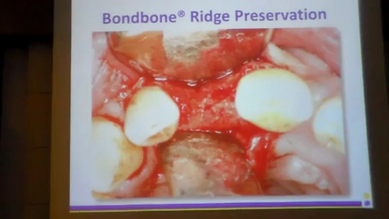 DR.DİŞHEKİMİ ERAN GABAY  - 9 MAYIS 2013 - ADO EĞİTİM SEMİNERİ 2