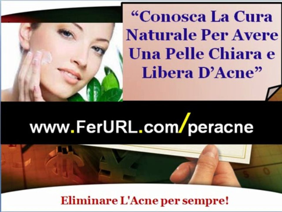 Come eliminare l'acne in modo naturale | Come curare l'acne sul viso