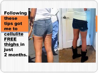 how to get rid of cellulite on legs tip 18 don't smoke