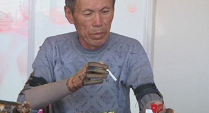 Un agriculteur chinois se fabrique ses propres bras bioniques