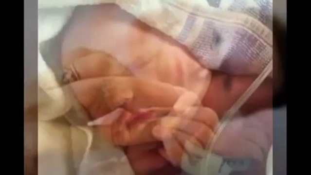 דוקטור אילון לחמן מציג תמונות של תינוקות