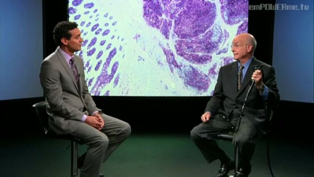Colon Cancer with Dr. Howard Schecter : MD-VOD