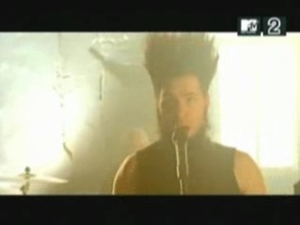static x - so