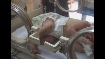 China 'pipe baby' mother raised alarm