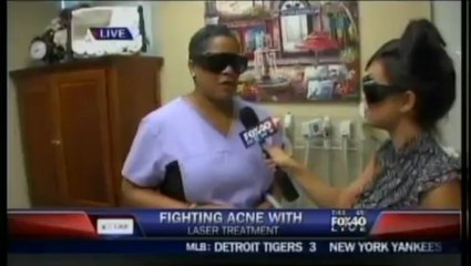 Acne Treatment with Laser Lights, Harmony XL from Alma Laser