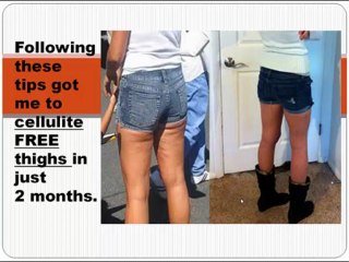how to get rid of cellulite naturally tip 2 - lose cellulite