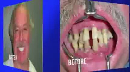 Dr. Irfan Atcha, Expert In Implant Dentistry In Chicago, On WGN-9 CW