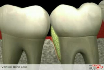 Dr. Irfan Atcha, All On 4 Implant Dentist Chicago Presents Educational Video