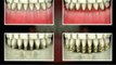 Implant Dentist Chicago Describes How Bacteria Deteriorate Jaw Bone Health