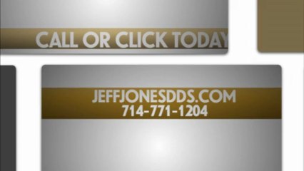 More Dr Jeff Jones DDS Villa Park CA Reviews