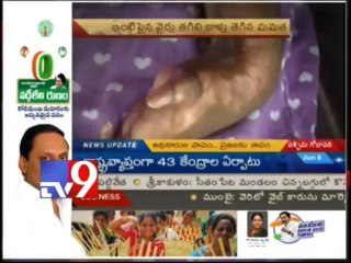 Electricity officials negligence makes girls handicapped