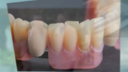 Choosing the Best San Antonio Periodontist