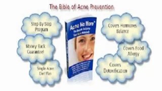 Natural Home Remedies: Home Remedies For Acne Treatment