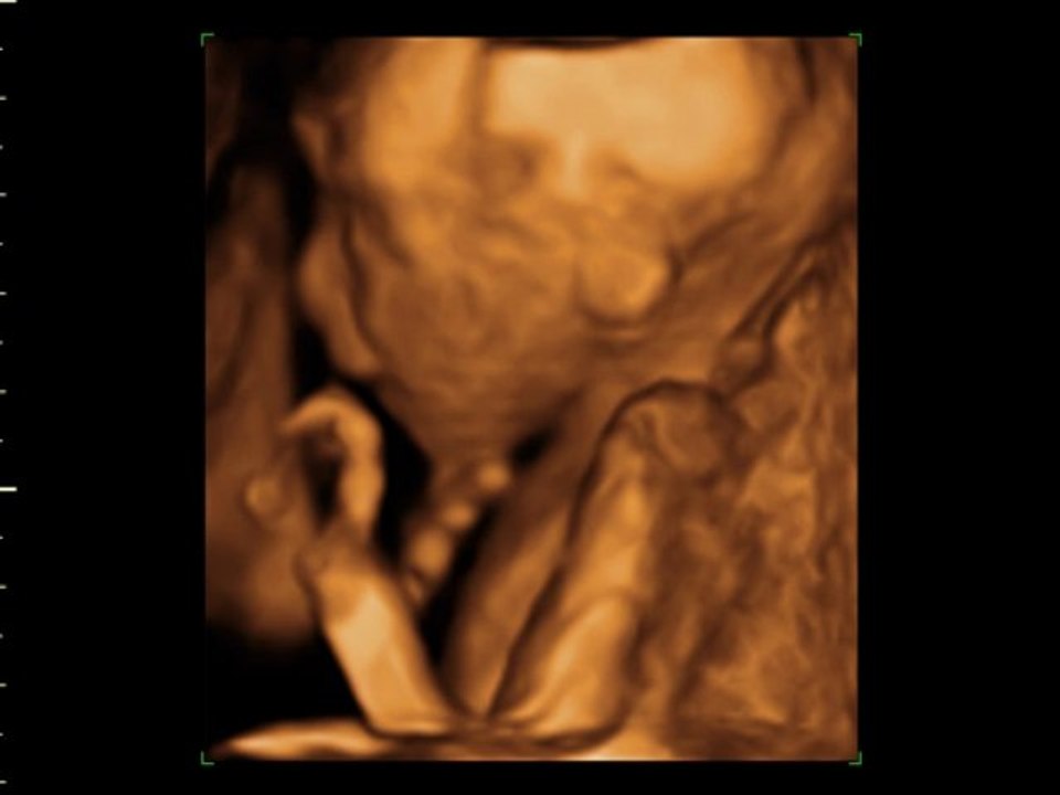 3 ve 4 boyutlu bebek görüntüleri