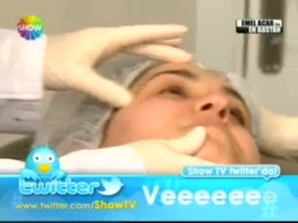 Benlerinizden Tamamen Kurtulun (Fraksiyonel CO2 Lazer)