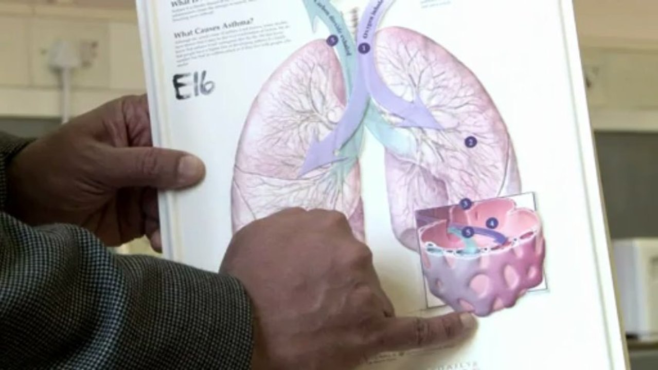 Mandela en "soins intensifs": interview d'un pneumologue