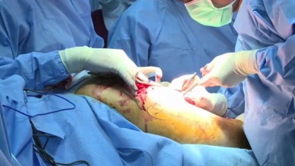 Jordanie – Débordée par l’afflux de réfugiés