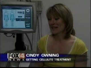 Cellulite - Treatments using Technology