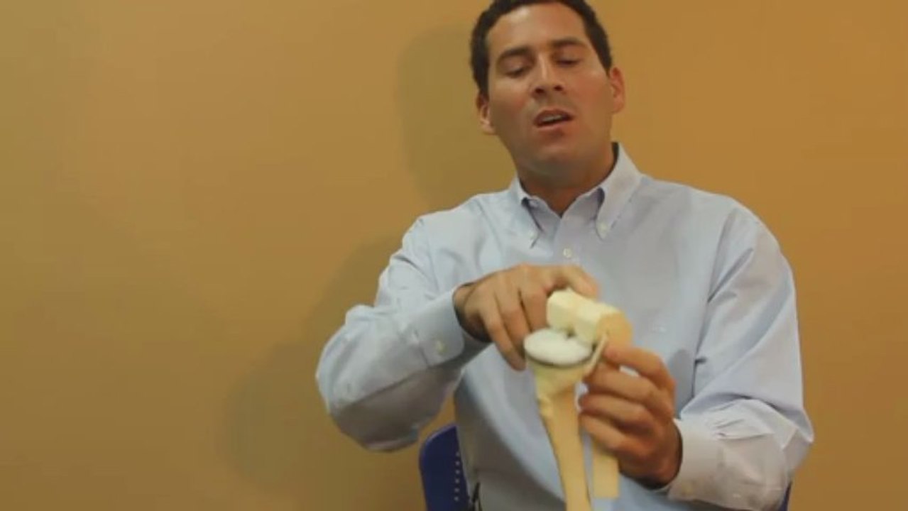 All About Knee Replacement Surgery by St Pete Hip and Knee