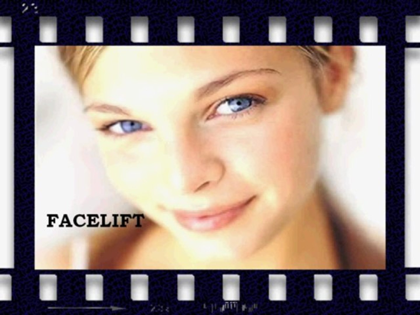 How safe is a plastic surgery?