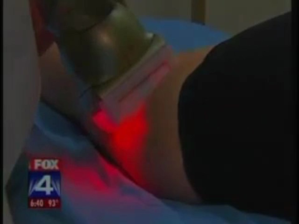 Cellulite - High Tech Cellulite Treatments