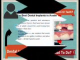 Austin Dental Implants - To Dental Implants Specialist in Austin - http://www.austin-dentist.net/dental-implants/