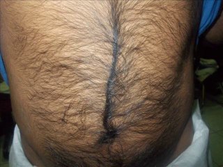 AYI GİBİ KILLARDAN NASIL KURTULURSUNUZ...! BU VİDEOYU İZLEYİN.