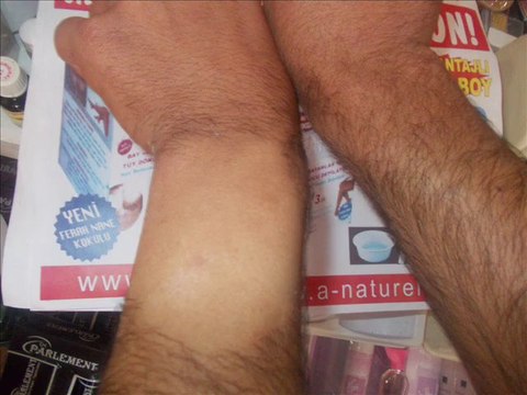 a-naturel tüy dökücü ve yok edici kozmetikbank