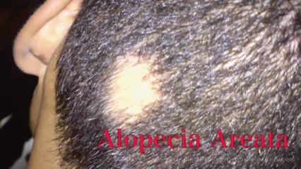 Physical Symptoms of Stress