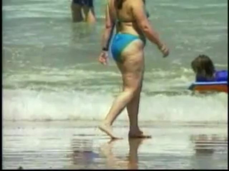 Cellulite - Its Causes